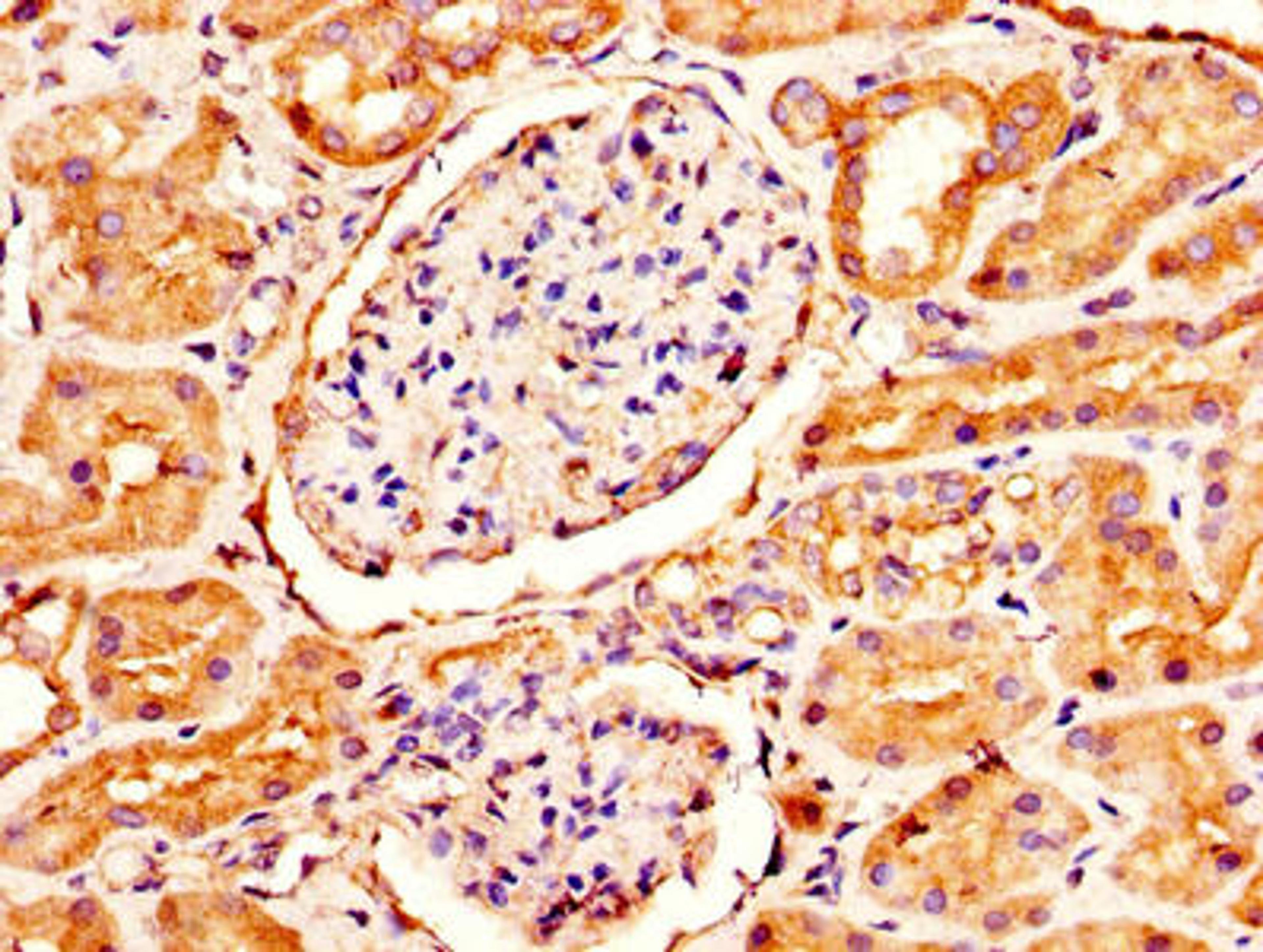 IHC image of CSB-PA613693LA01HU diluted at 1:300 and staining in paraffin-embedded human kidney tissue performed on a Leica BondTM system. After dewaxing and hydration, antigen retrieval was mediated by high pressure in a citrate buffer (pH 6.0). Section was blocked with 10% normal goat serum 30min at RT. Then primary antibody (1% BSA) was incubated at 4&deg;C overnight. The primary is detected by a biotinylated secondary antibody and visualized using an HRP conjugated SP system.