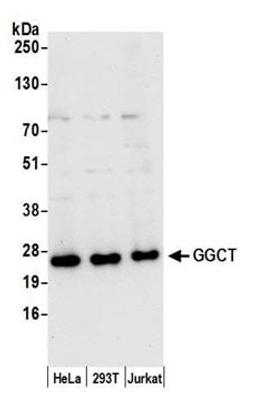 Detection of human GGCT by western blot.