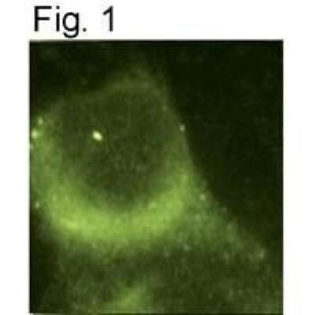 Immunocytochemistry/Immunofluorescence: Presenilin-1 Antibody (APS 18) [NB100-74510] - Staining of PS1 in mouse fibroblasts.