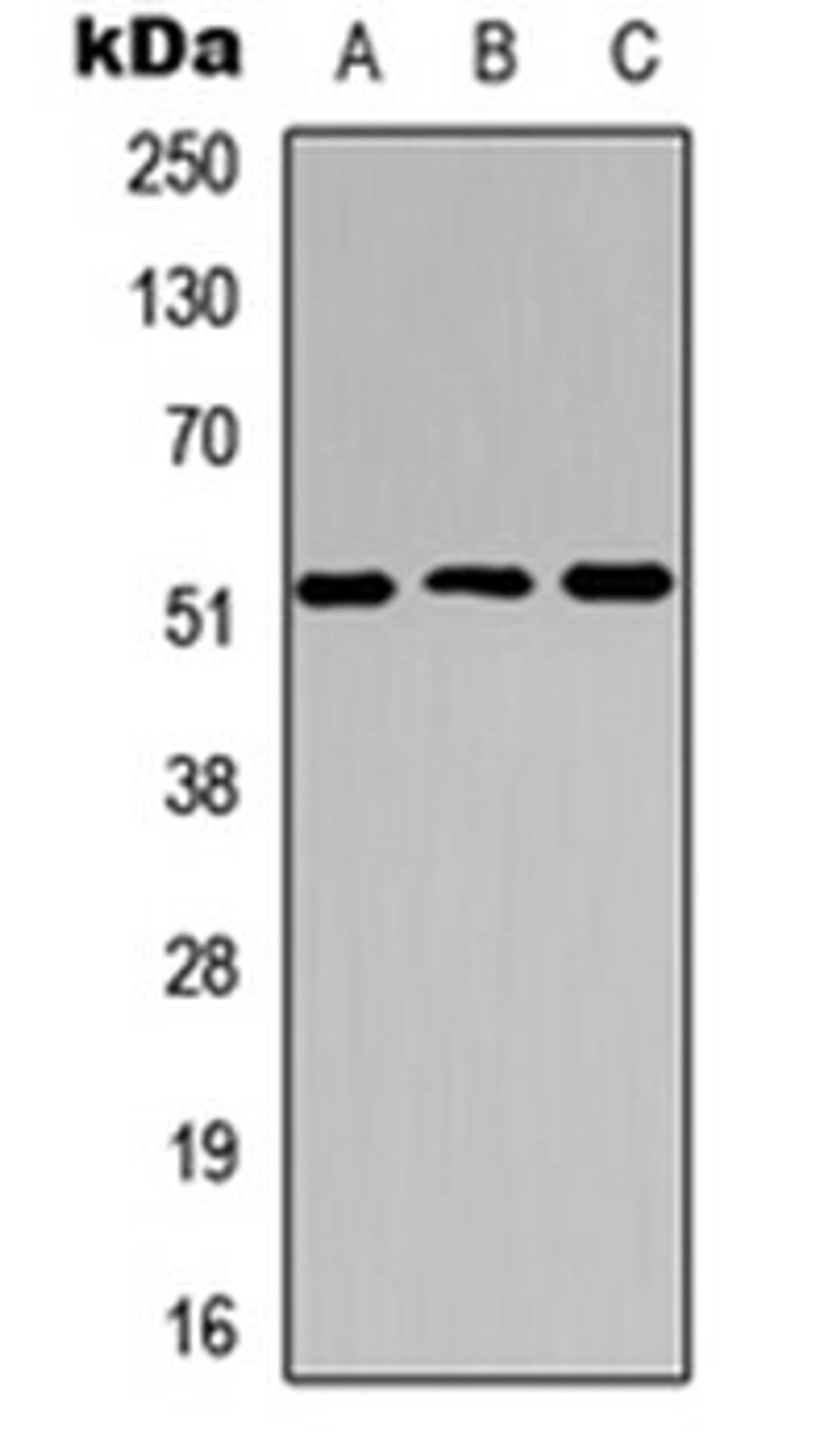 Western blot analysis of HEK293T (Lane 1), Raw264.7 (Lane 2), PC12 (Lane 3) whole cell lysates using Cathepsin C LC antibody