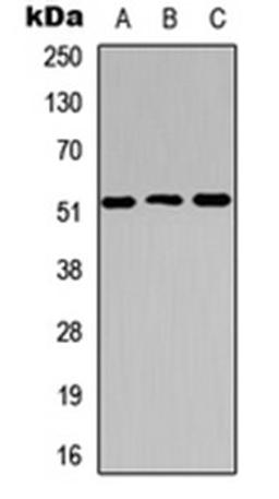 Western blot analysis of HEK293T (Lane 1), Raw264.7 (Lane 2), PC12 (Lane 3) whole cell lysates using Cathepsin C LC antibody