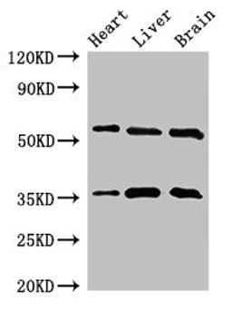 Western Blot. Positive WB detected in: Mouse heart tissue, Mouse liver tissue, Mouse brain tissue. All lanes: STK35 antibody at 2.5ug/ml. Secondary. Goat polyclonal to rabbit IgG at 1/50000 dilution. Predicted band size: 59 kDa. Observed band size: 59, 36 kDa. 