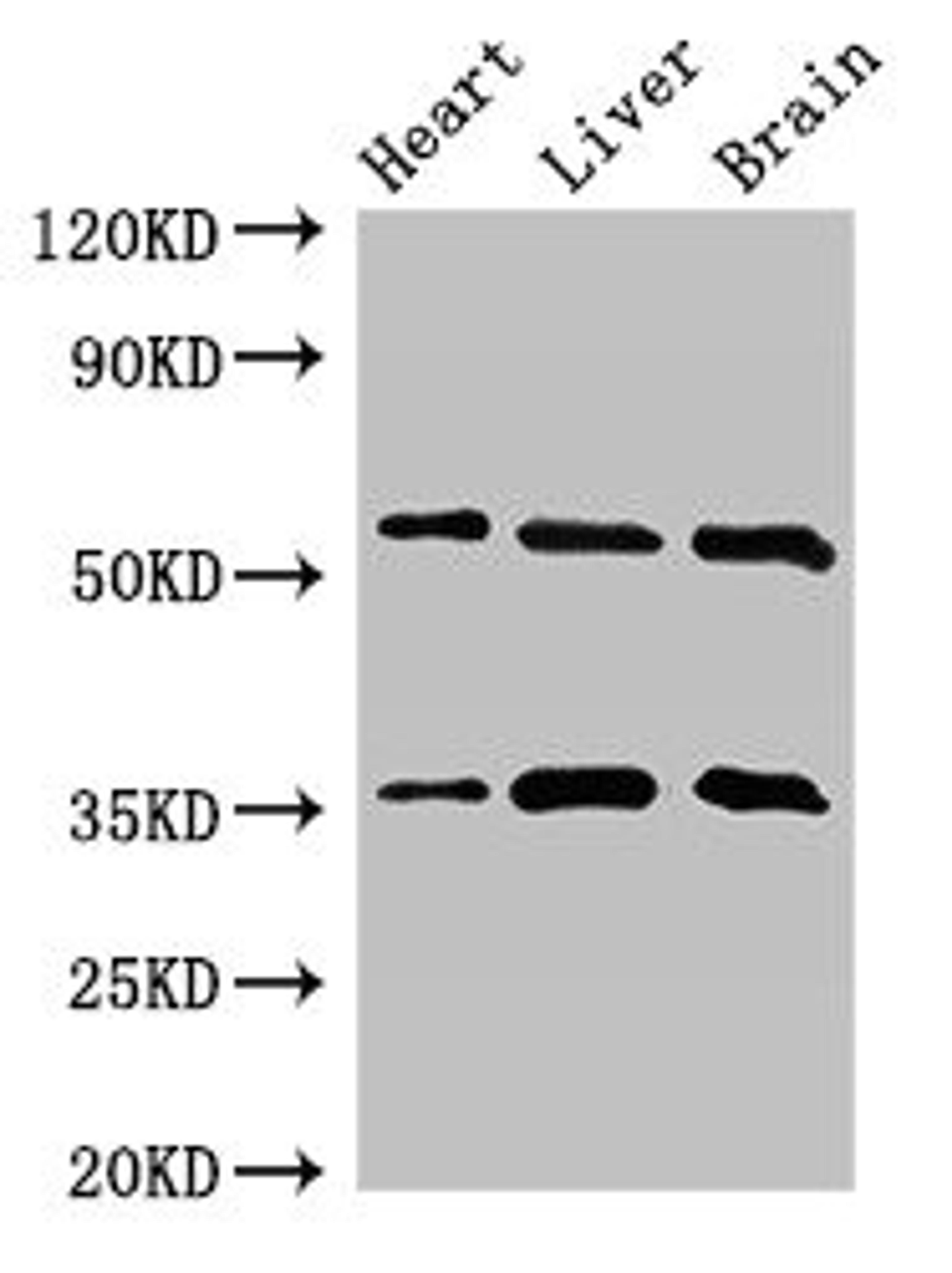 Western Blot. Positive WB detected in: Mouse heart tissue, Mouse liver tissue, Mouse brain tissue. All lanes: STK35 antibody at 2.5ug/ml. Secondary. Goat polyclonal to rabbit IgG at 1/50000 dilution. Predicted band size: 59 kDa. Observed band size: 59, 36 kDa. 