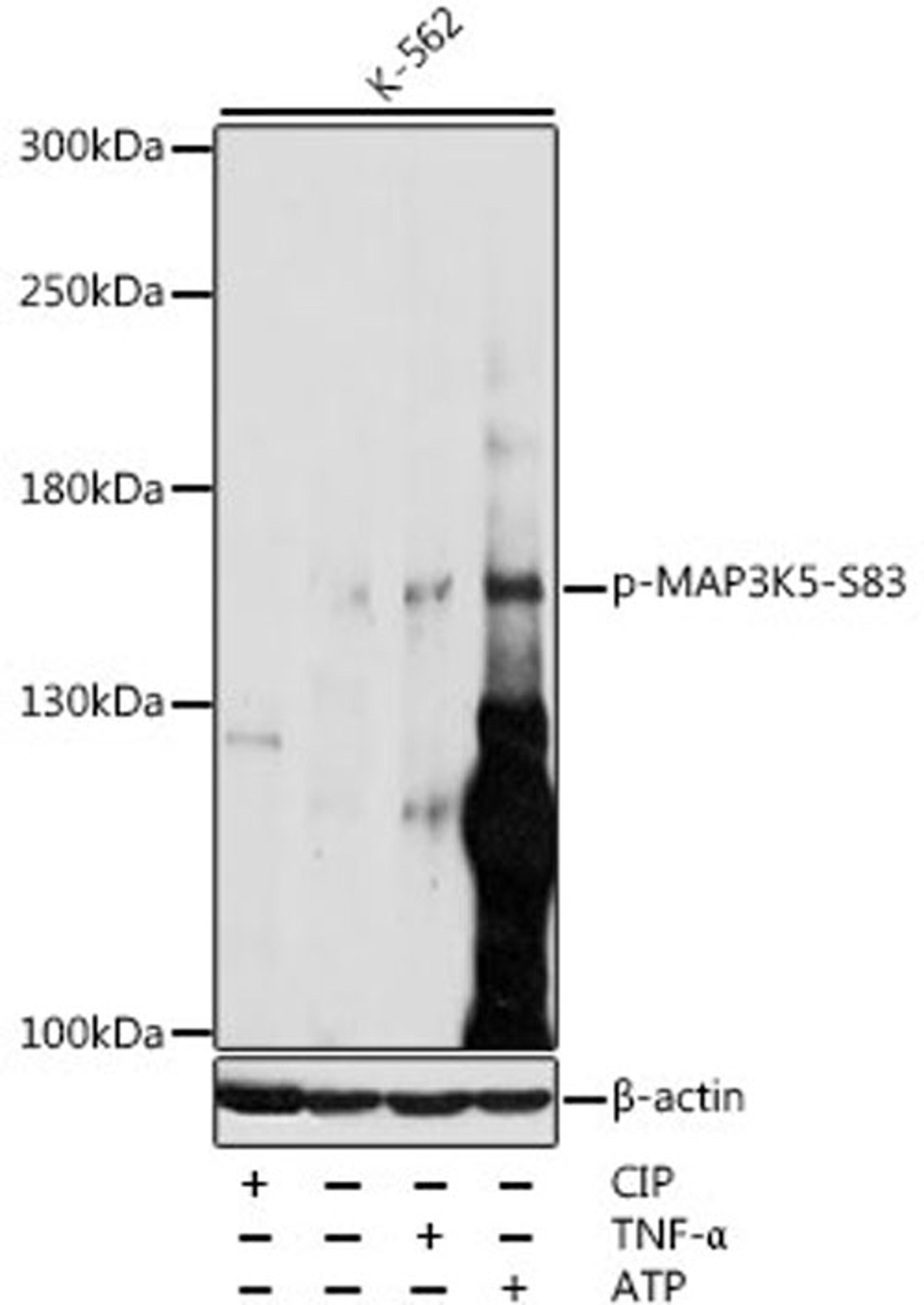 Western blot - Phospho-MAP3K5-S83 antibody (AP0059)