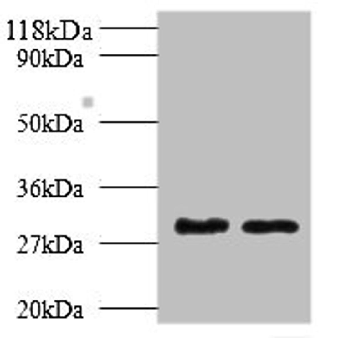 Western blot. All lanes: Tpsb2 antibody at 2µg/ml. Lane 1: Mouse heart tissue. Lane 2: Rat heart tissue. Secondary. Goat polyclonal to rabbit IgG at 1/10000 dilution. Predicted band size: 31, 26 kDa. Observed band size: 31 kDa
