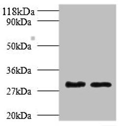 Western blot. All lanes: Tpsb2 antibody at 2µg/ml. Lane 1: Mouse heart tissue. Lane 2: Rat heart tissue. Secondary. Goat polyclonal to rabbit IgG at 1/10000 dilution. Predicted band size: 31, 26 kDa. Observed band size: 31 kDa