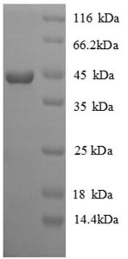 (Tris-Glycine gel) Discontinuous SDS-PAGE (reduced) with 5% enrichment gel and 15% separation gel.