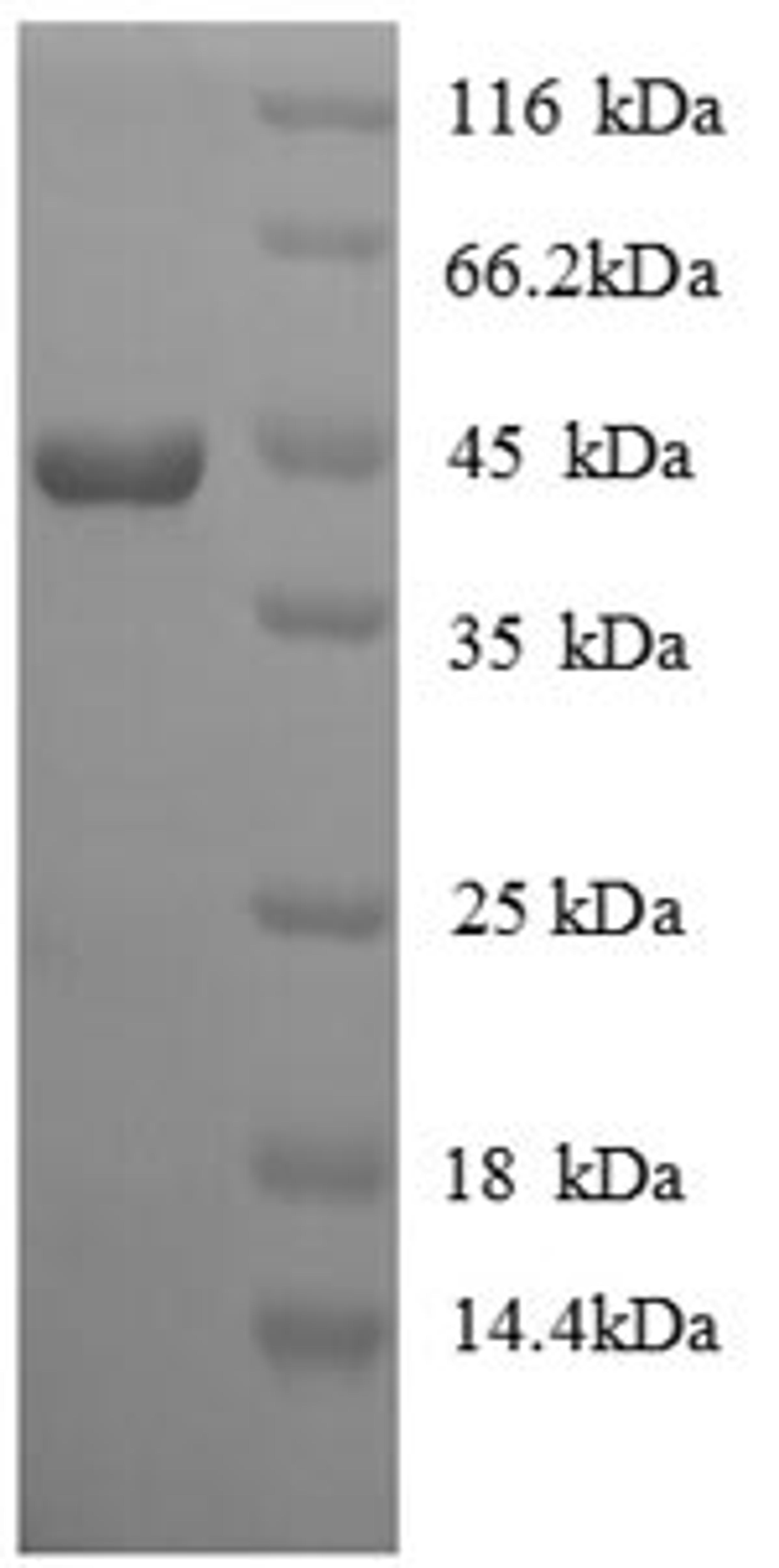 (Tris-Glycine gel) Discontinuous SDS-PAGE (reduced) with 5% enrichment gel and 15% separation gel.