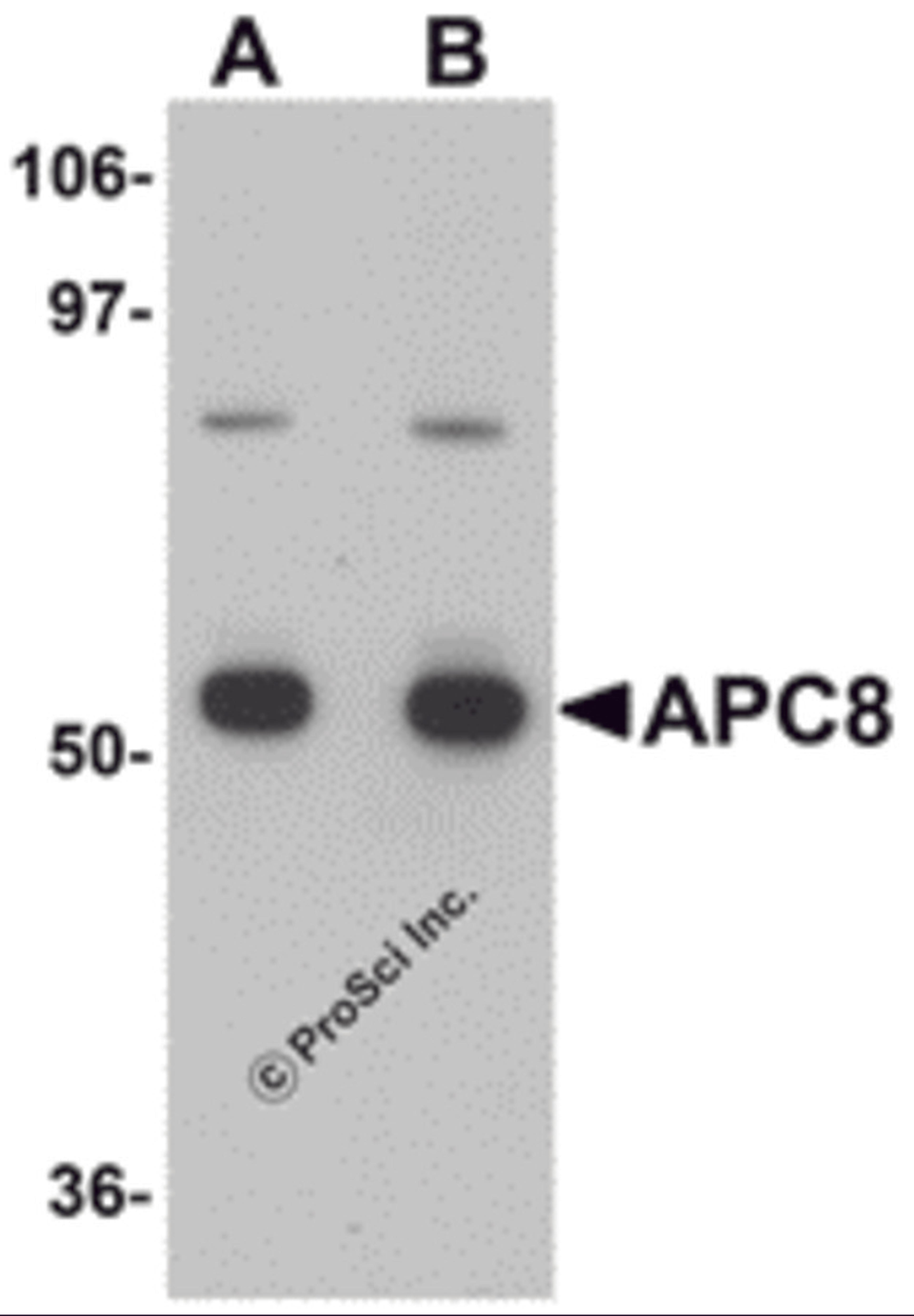 Western blot analysis of APC8 in K562 cell lysate with APC8 antibody at (A) 1 and (B) 2 &#956;g/mL.