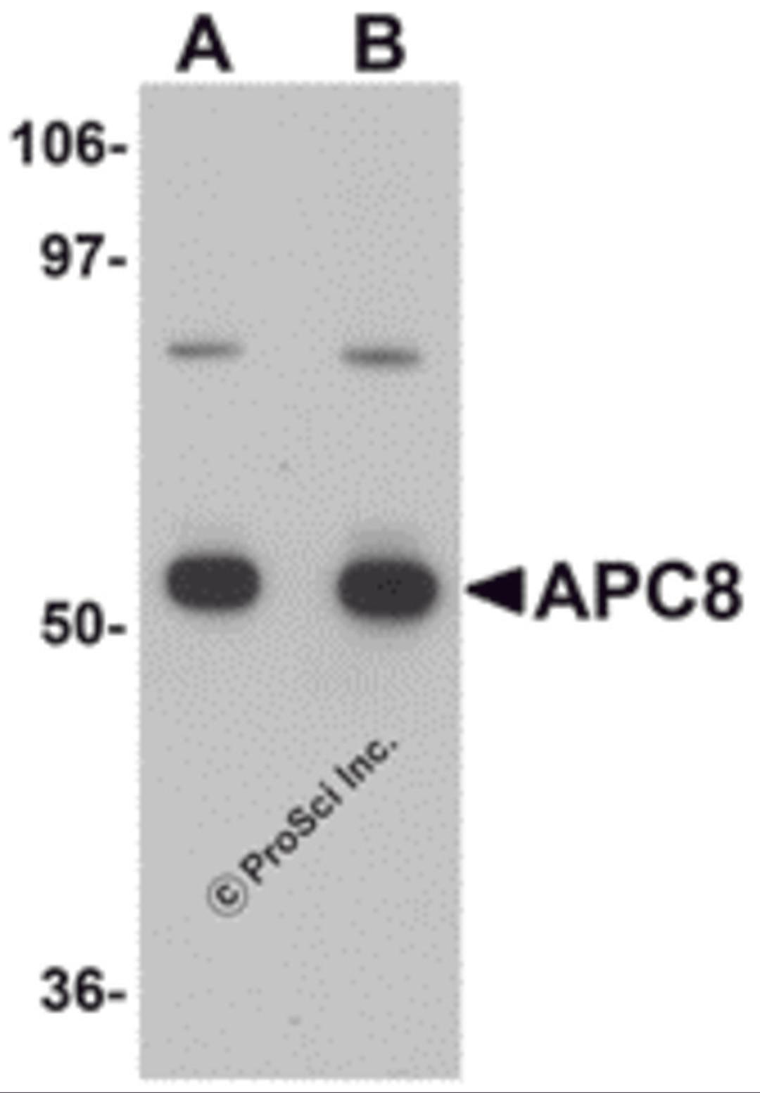 Western blot analysis of APC8 in K562 cell lysate with APC8 antibody at (A) 1 and (B) 2 μg/mL.
