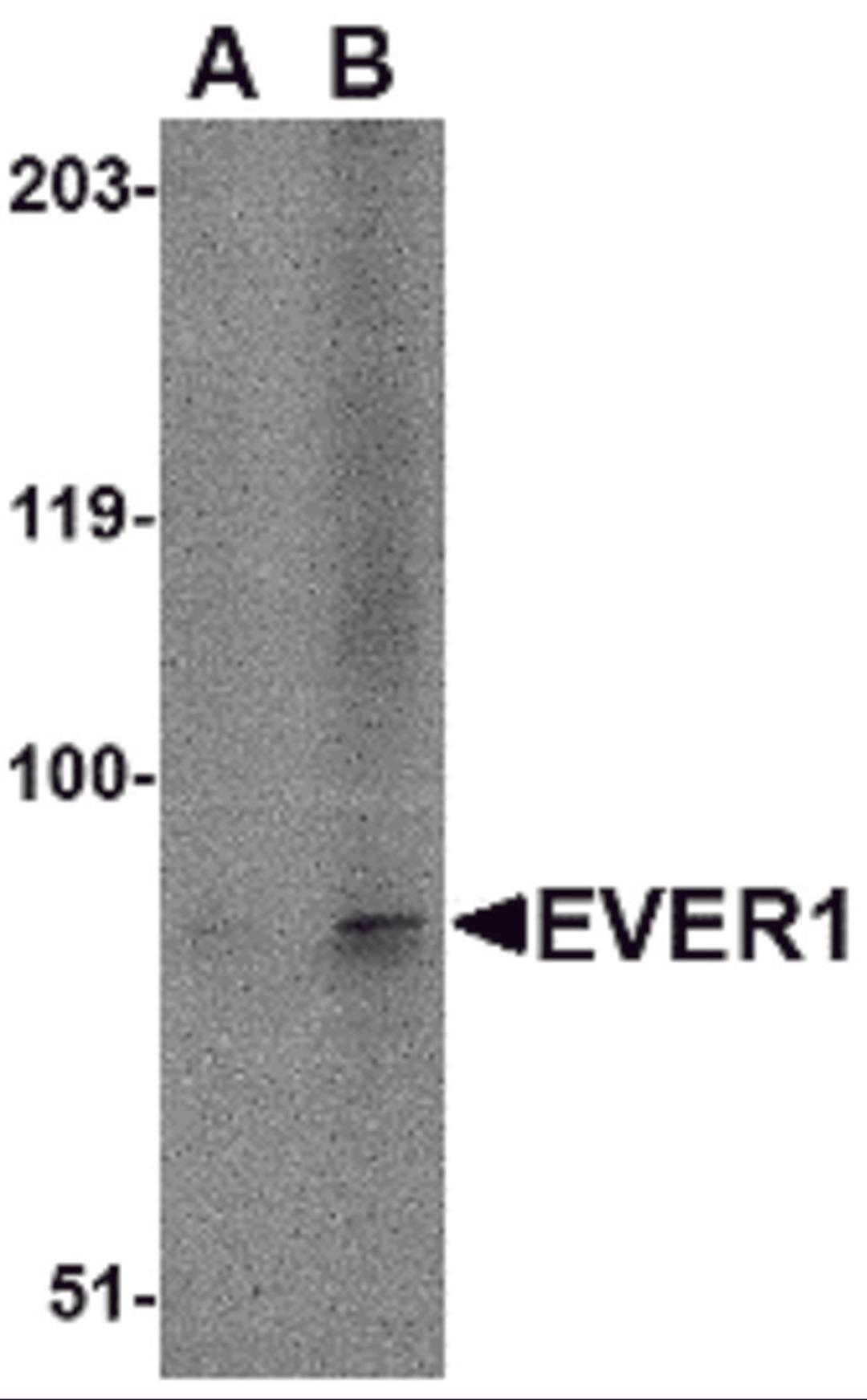 Western blot analysis of EVER1 in A-20 cell lysate with EVER1 antibody at (A) 1 and (B) 2 &#956;g/mL.