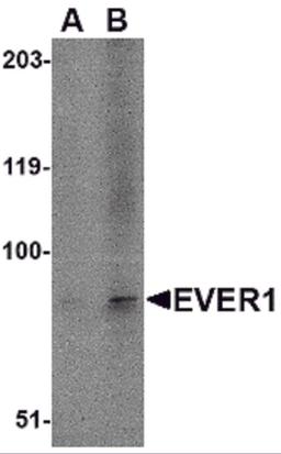 Western blot analysis of EVER1 in A-20 cell lysate with EVER1 antibody at (A) 1 and (B) 2 &#956;g/mL.