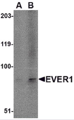 Western blot analysis of EVER1 in A-20 cell lysate with EVER1 antibody at (A) 1 and (B) 2 μg/mL.