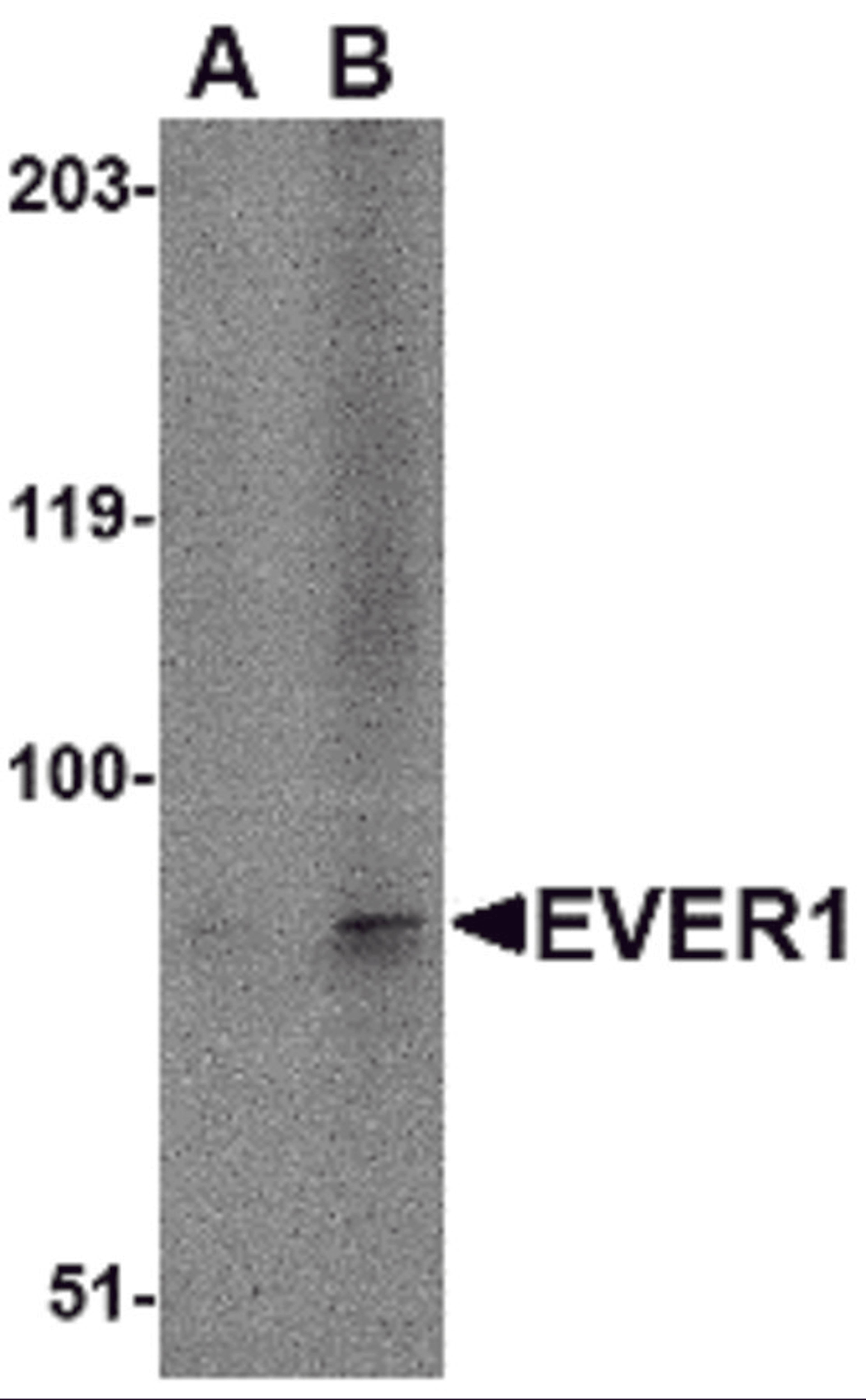 Western blot analysis of EVER1 in A-20 cell lysate with EVER1 antibody at (A) 1 and (B) 2 μg/mL.