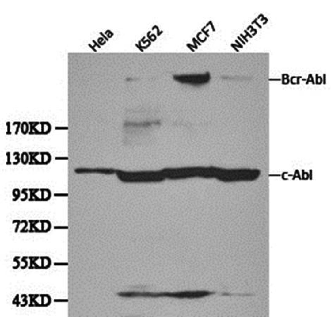 Western blot analysis of Hela, K562,Mcf7,NIH3T3 cell line lysates using ABL1 antibody