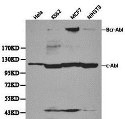 Western blot analysis of Hela, K562,Mcf7,NIH3T3 cell line lysates using ABL1 antibody