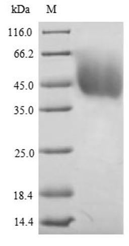 (Tris-Glycine gel) Discontinuous SDS-PAGE (reduced) with 5% enrichment gel and 15% separation gel.