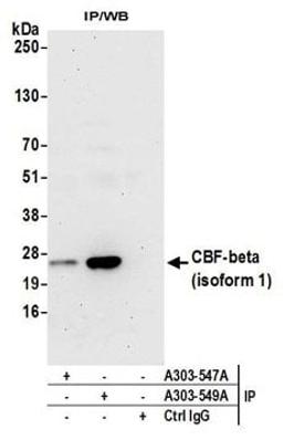 Detection of human CBF-beta (isoform 1) by western blot of immunoprecipitates.