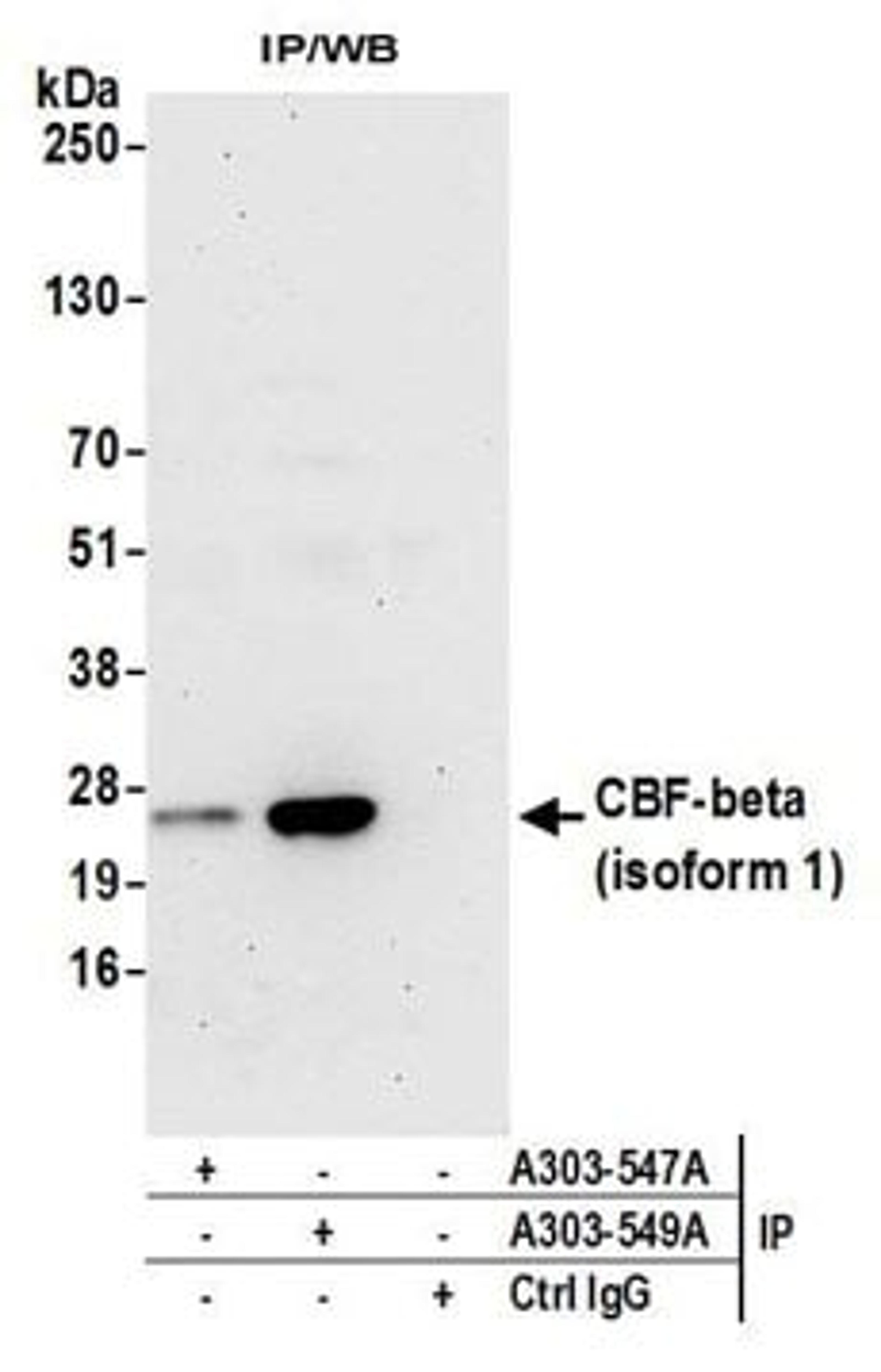 Detection of human CBF-beta (isoform 1) by western blot of immunoprecipitates.