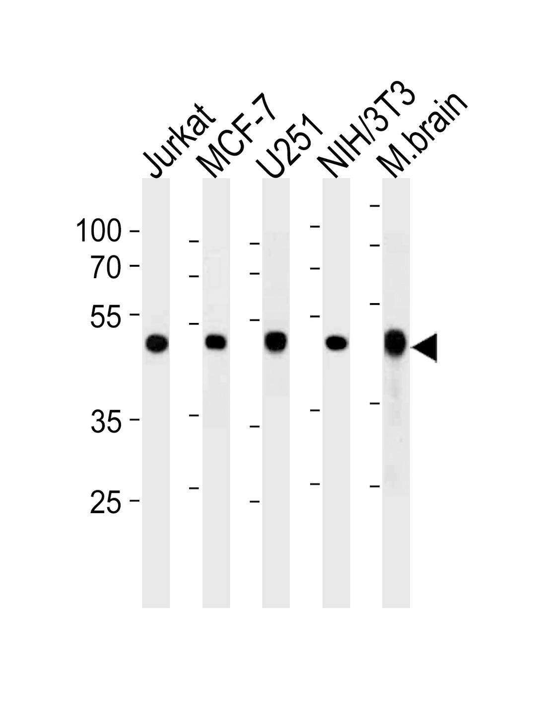 Western blot analysis in Jurkat,MCF-7,U251,mouse NIH/3T3 cell line and mouse brain tissue lysates (35ug/lane).