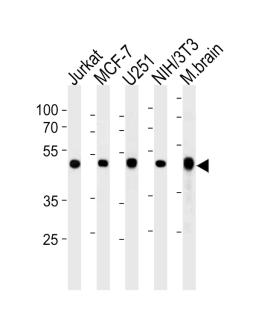 Western blot analysis in Jurkat,MCF-7,U251,mouse NIH/3T3 cell line and mouse brain tissue lysates (35ug/lane).