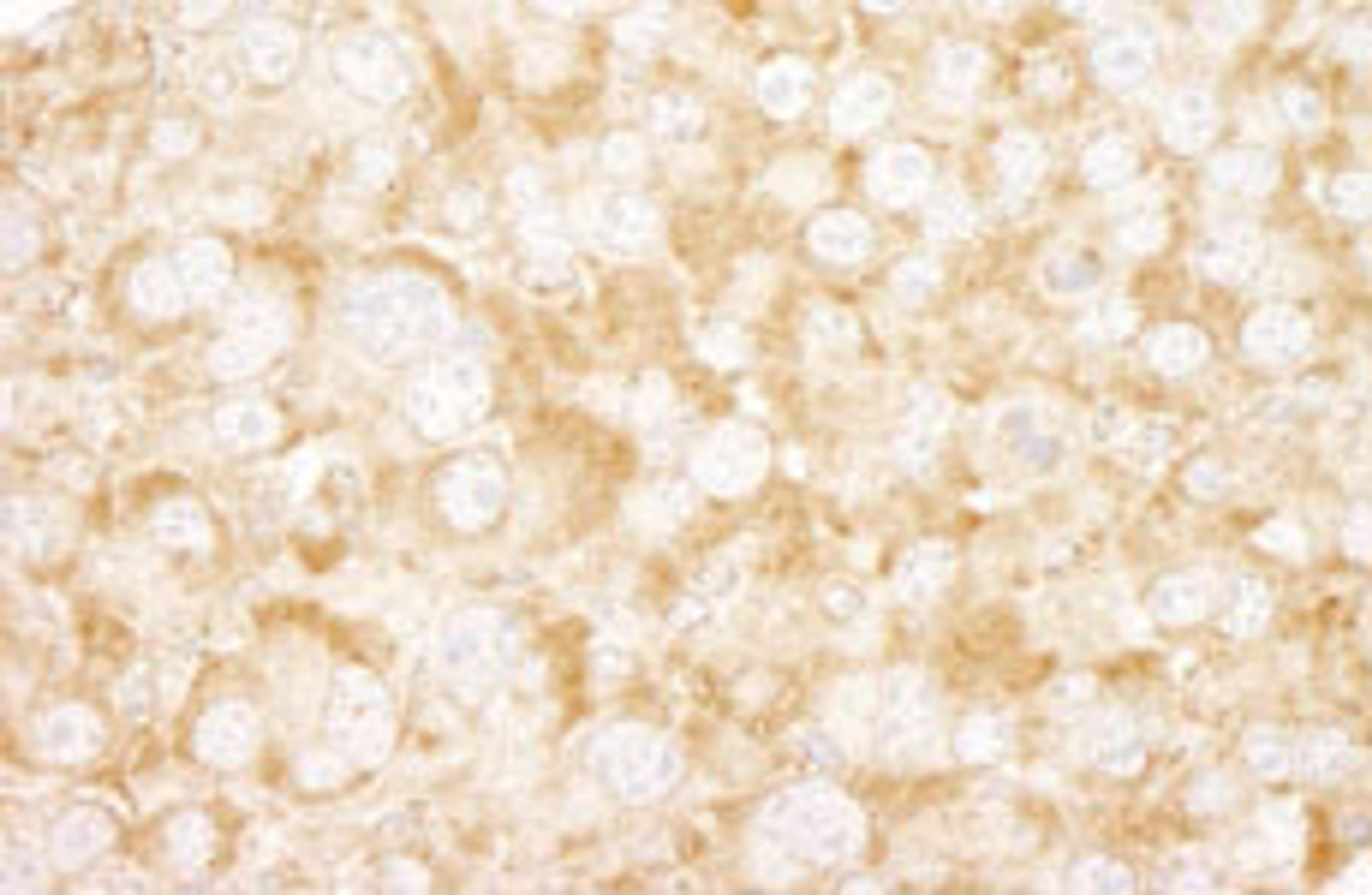 Detection of mouse UVRAG by immunohistochemistry.