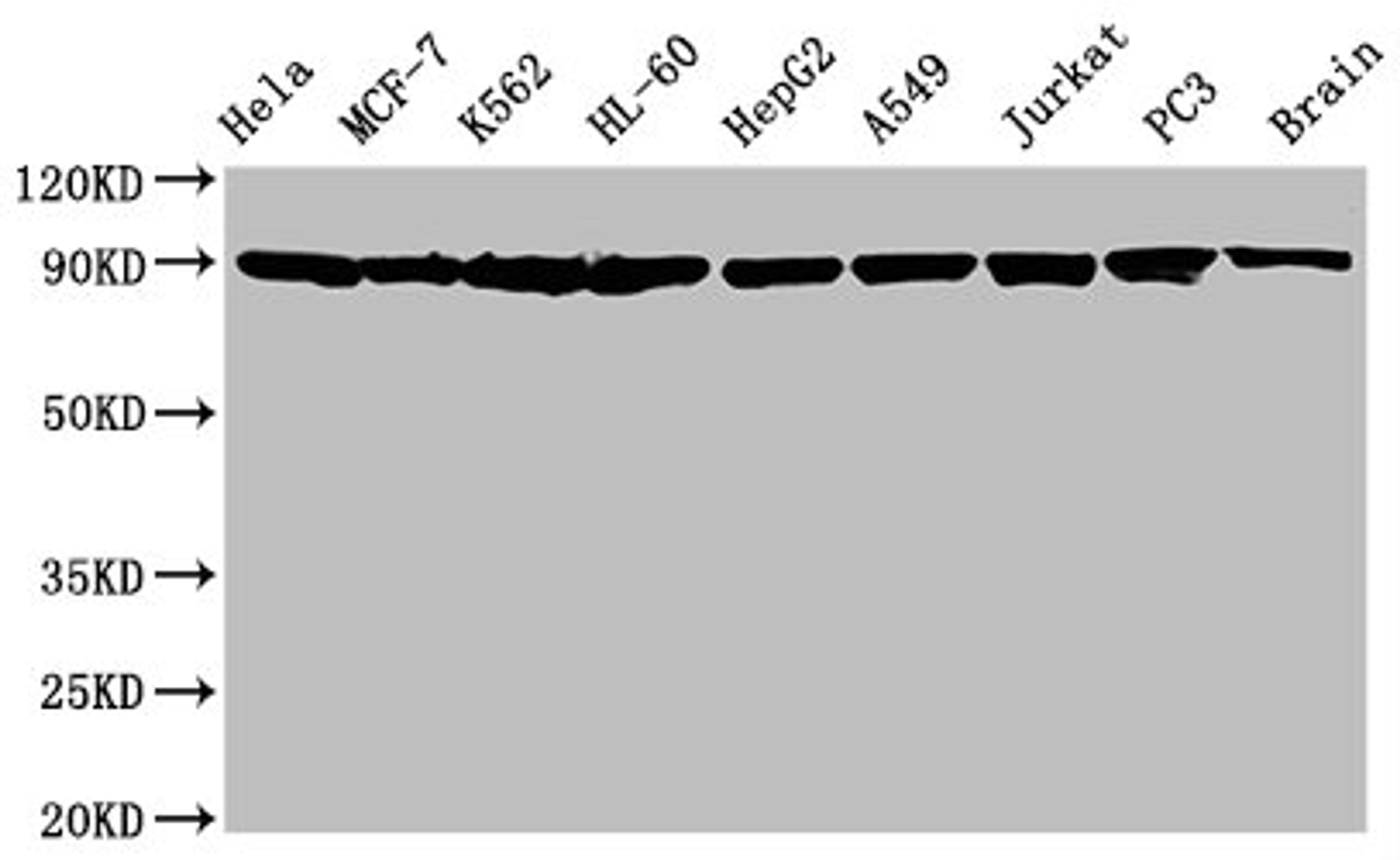 Western Blot. Positive WB detected in: Hela whole cell lysate, MCF-7 whole cell lysate, K562 whole cell lysate, HL-60 whole cell lysate, HepG2 whole cell lysate, A549 whole cell lysate, Jurkat whole cell lysate, PC3 whole cell lysate, Rat brain tissue. All lanes: Hsp90 alpha + beta antibody at 1.25μg/ml. Secondary. Goat polyclonal to rabbit IgG at 1/50000 dilution. Predicted band size: 90 KDa. Observed band size: 90 KDa.