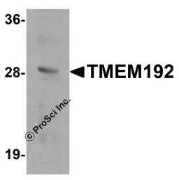 Western blot analysis of TMEM192 in SK-N-SH cell lysate with TMEM192 antibody at 0.5 μg/mL.