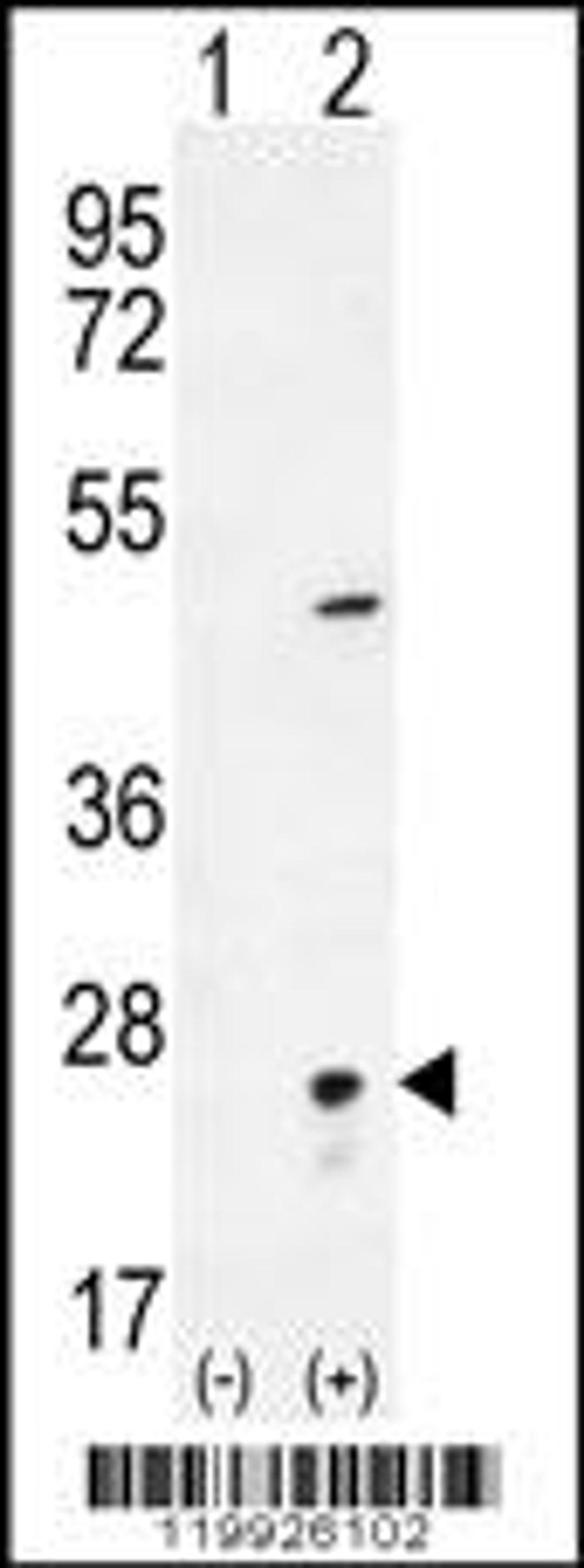 Western blot analysis of VSNL1 using rabbit polyclonal VSNL1 Antibody using 293 cell lysates (2 ug/lane) either nontransfected (Lane 1) or transiently transfected (Lane 2) with the VSNL1 gene.