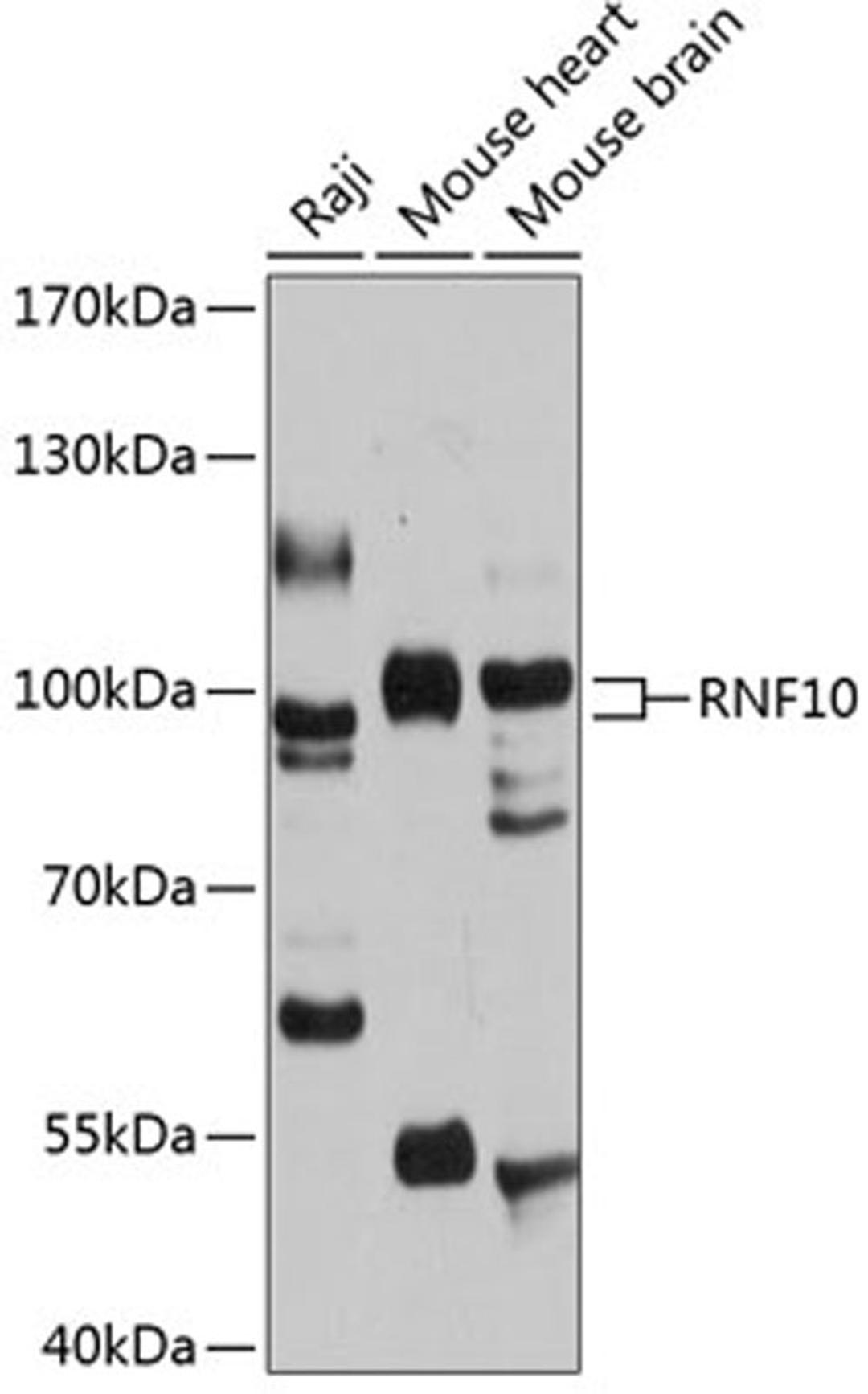 Western blot - RNF10 antibody (A12296)