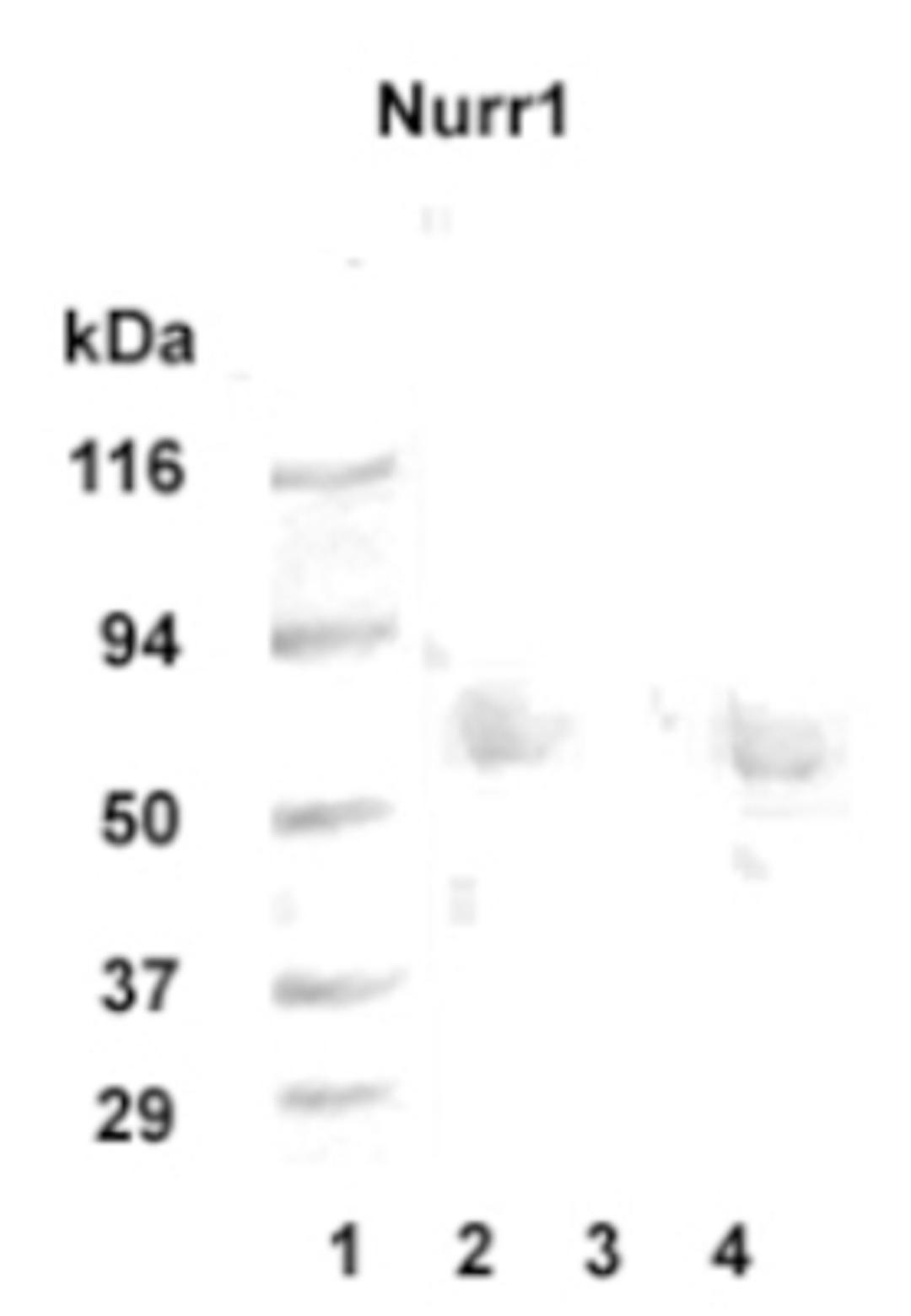 Western Blot: Nurr1 Antibody [NB110-40415] - Western blot detection of Nurr1 in 20 ug of human hippocampus tissue lysate (lanes 2 and 4) with Nurr1 polyclonal at 1:1000 dilution followed by AP-conjugated secondary at 1:5000 dilution. MW marker lane 1. Peptide absorption control lane 3.