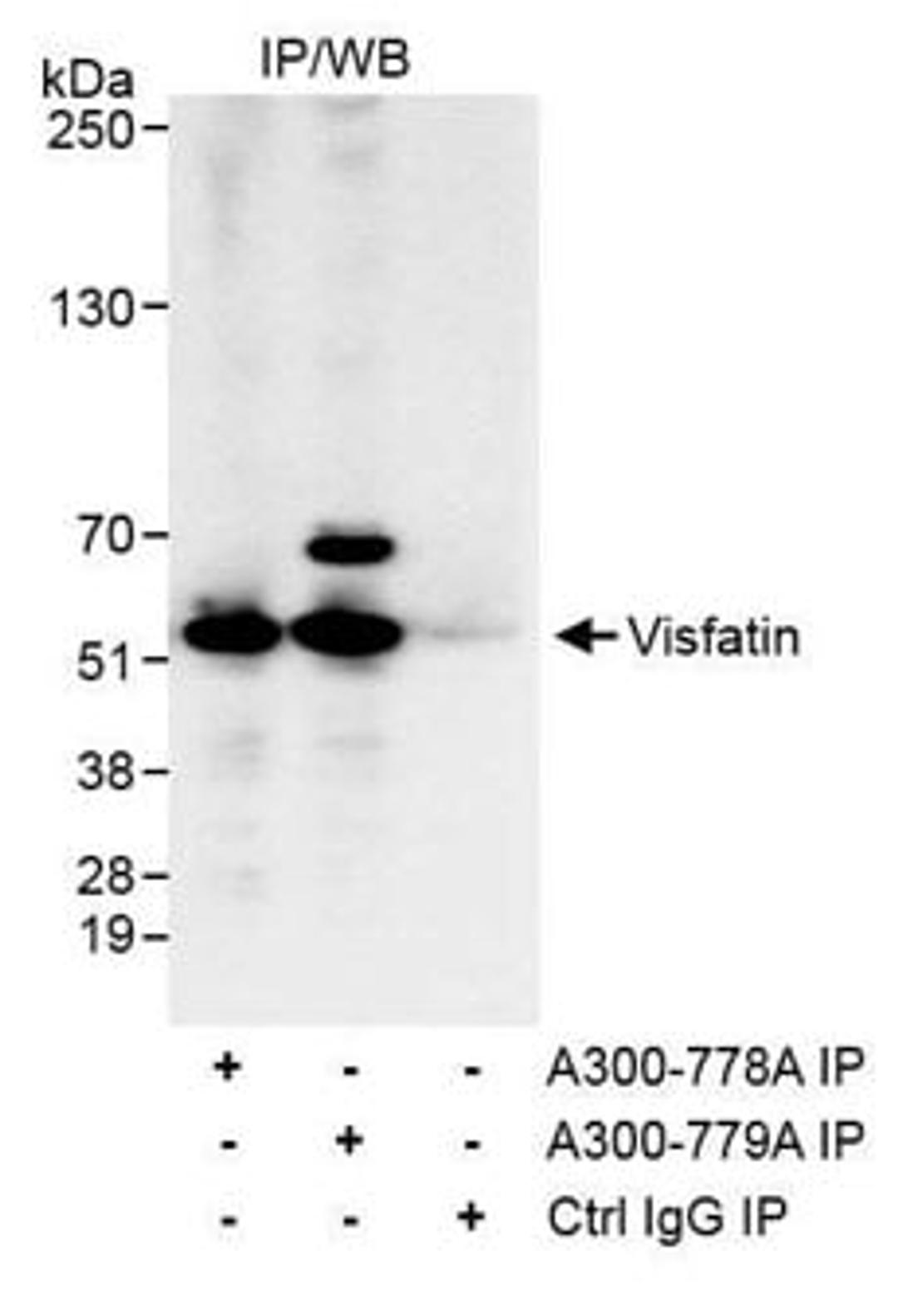 Detection of human Visfatin by western blot of immunoprecipitates.