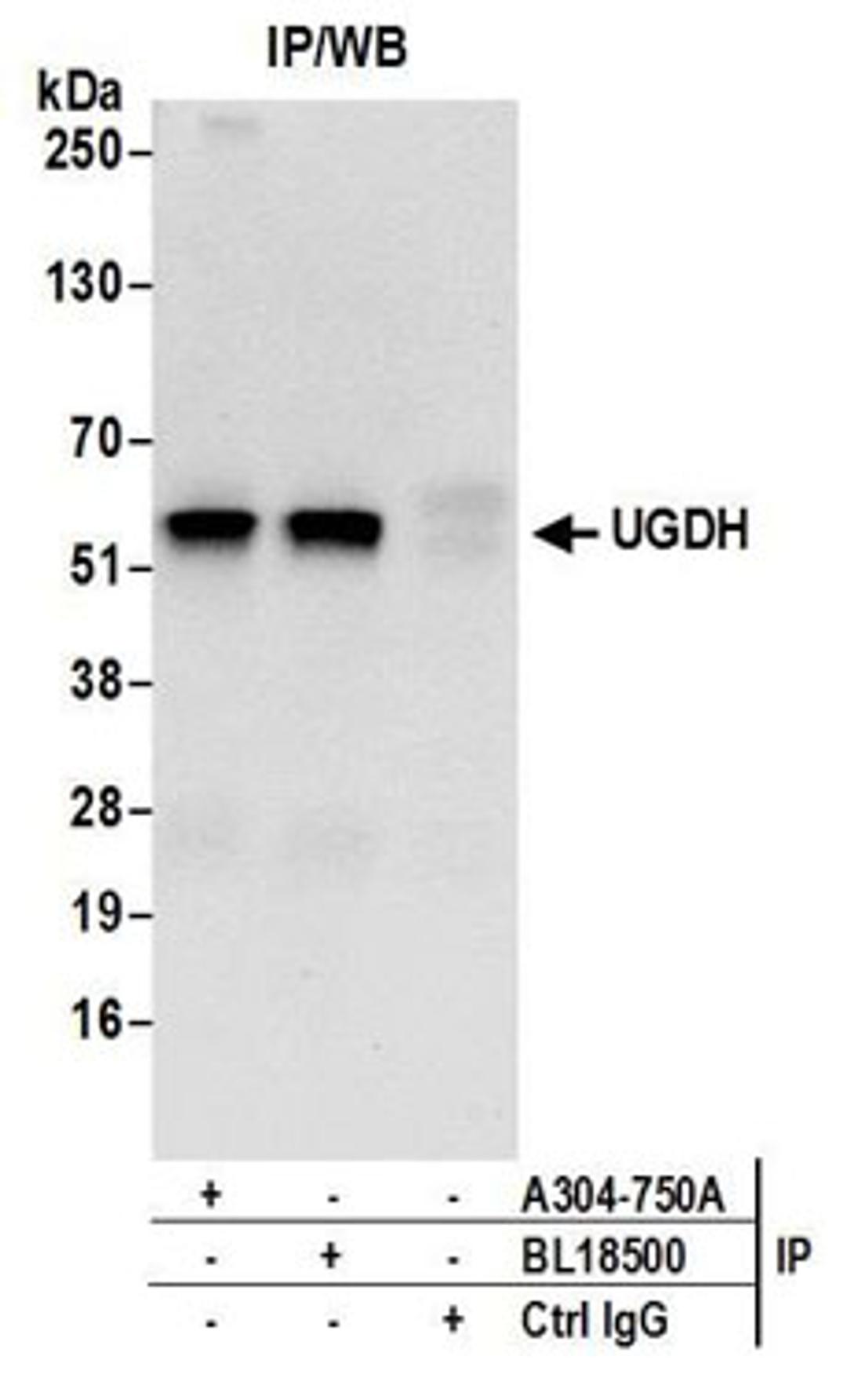 Detection of human UGDH by western blot of immunoprecipitates.