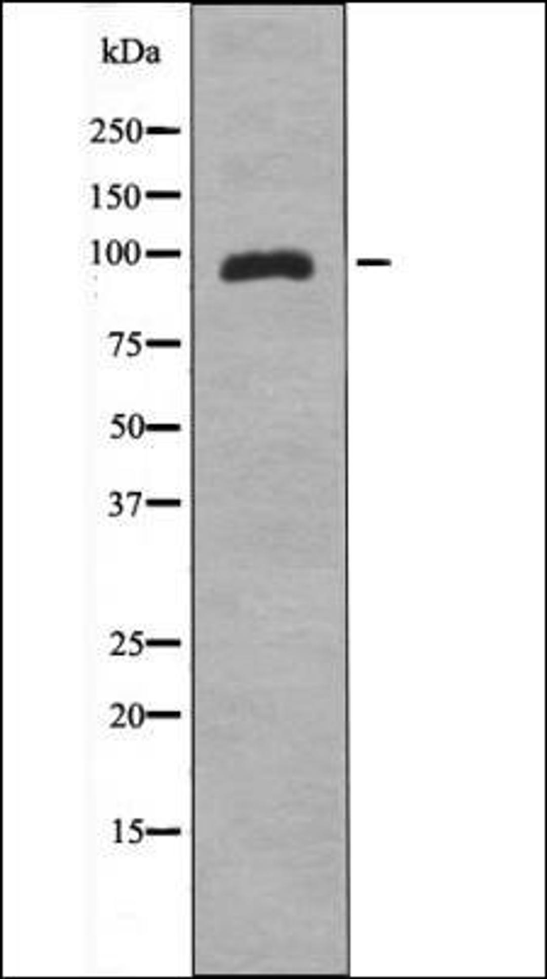 Western blot analysis of HeLa whole cell lysates using ZAK -Phospho-Ser165- antibody