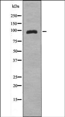 Western blot analysis of HeLa whole cell lysates using ZAK -Phospho-Ser165- antibody