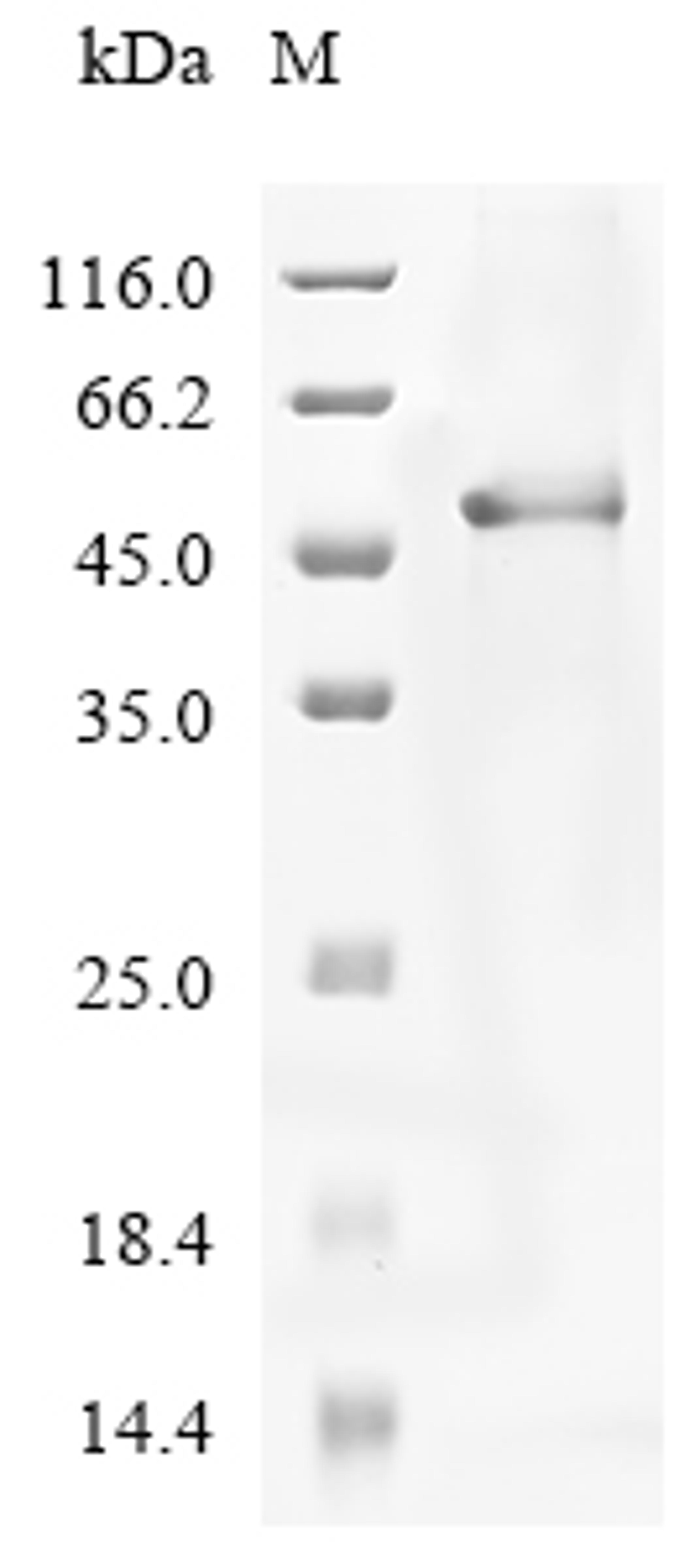 (Tris-Glycine gel) Discontinuous SDS-PAGE (reduced) with 5% enrichment gel and 15% separation gel.