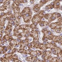 Immunohistochemistry: ACSM2A Antibody [NBP2-46841] - Analysis of human liver tissue.