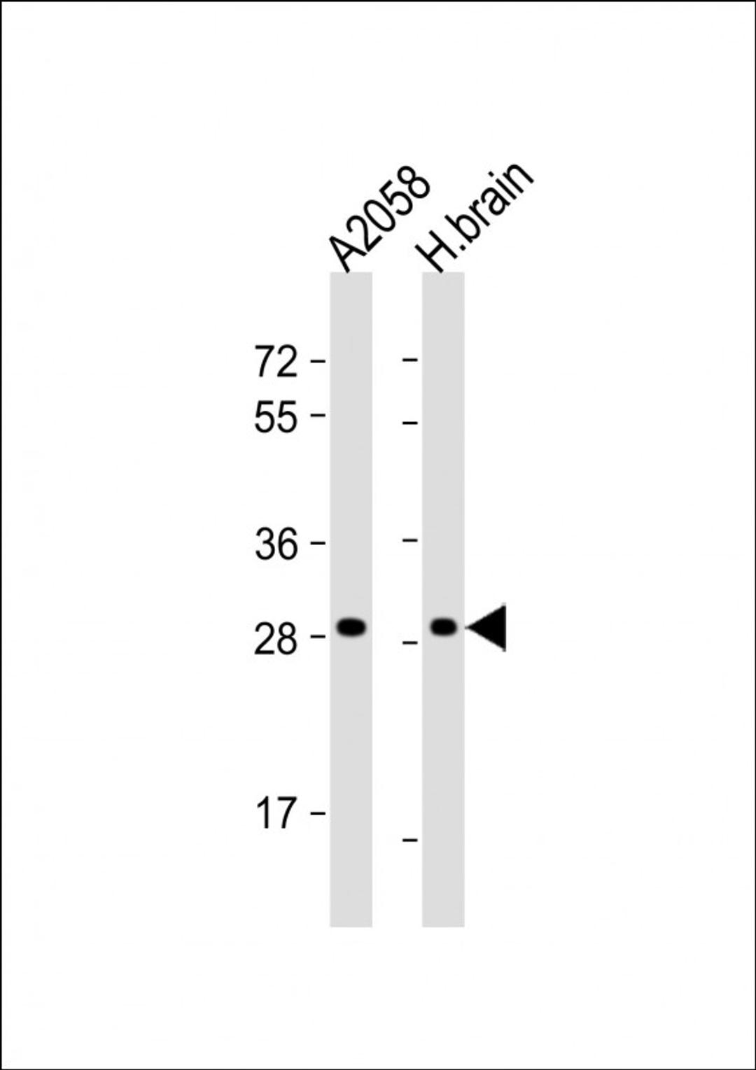 Western Blot at 1:1000 dilution Lane 1: A2058 whole cell lysate Lane 2: human brain lysate Lysates/proteins at 20 ug per lane.