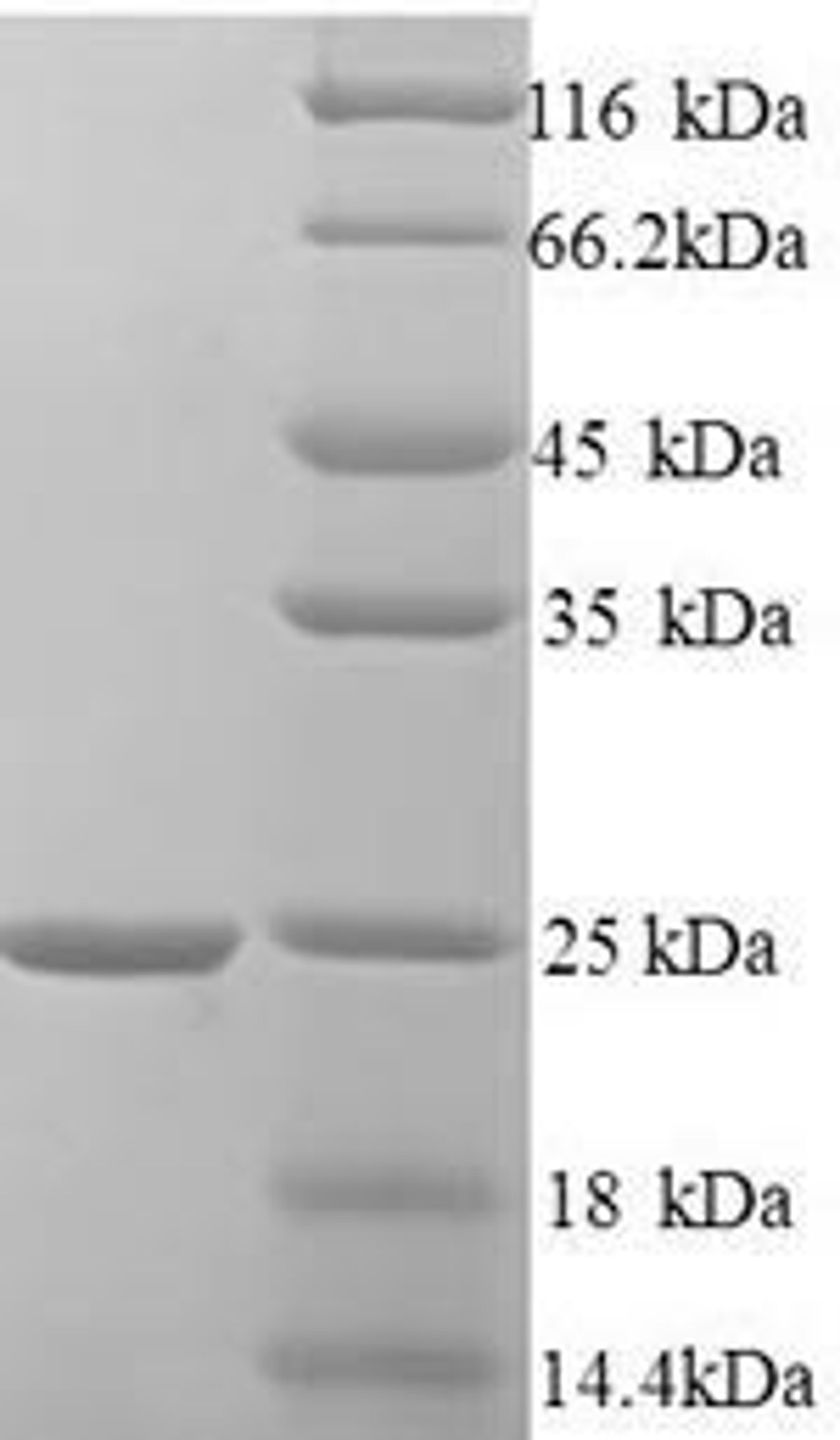 (Tris-Glycine gel) Discontinuous SDS-PAGE (reduced) with 5% enrichment gel and 15% separation gel.