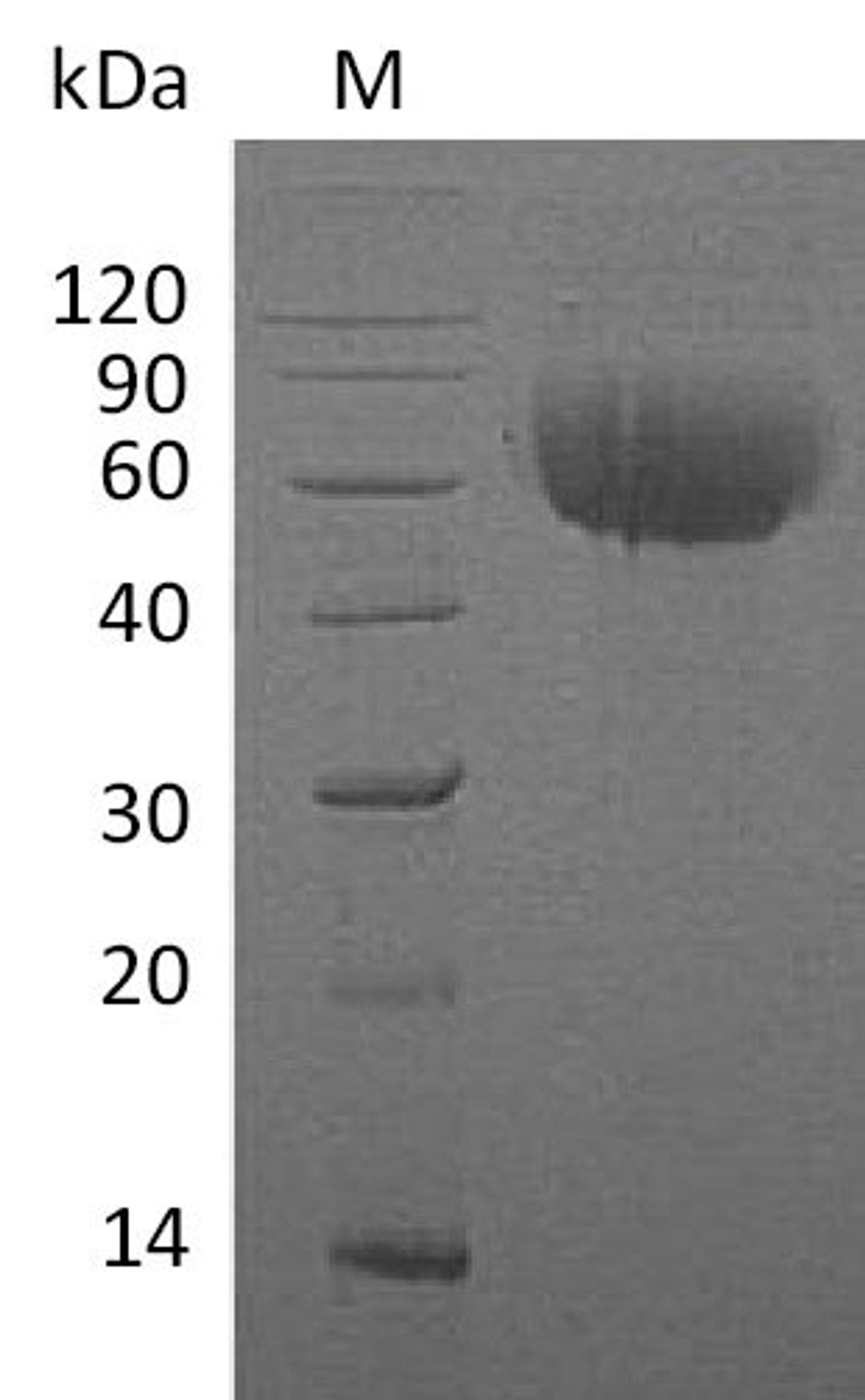 (Tris-Glycine gel) Discontinuous SDS-PAGE (reduced) with 5% enrichment gel and 15% separation gel.