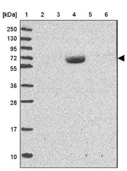 Western Blot: LRRC24 Antibody [NBP2-33643] - Lane 1: Marker [kDa] 250, 130, 95, 72, 55, 36, 28, 17, 10<br/>Lane 2: Human cell line RT-4<br/>Lane 3: Human cell line U-251MG sp<br/>Lane 4: Human plasma (IgG/HSA depleted)<br/>Lane 5: Human liver tissue<br/>Lane 6: Human tonsil tissue