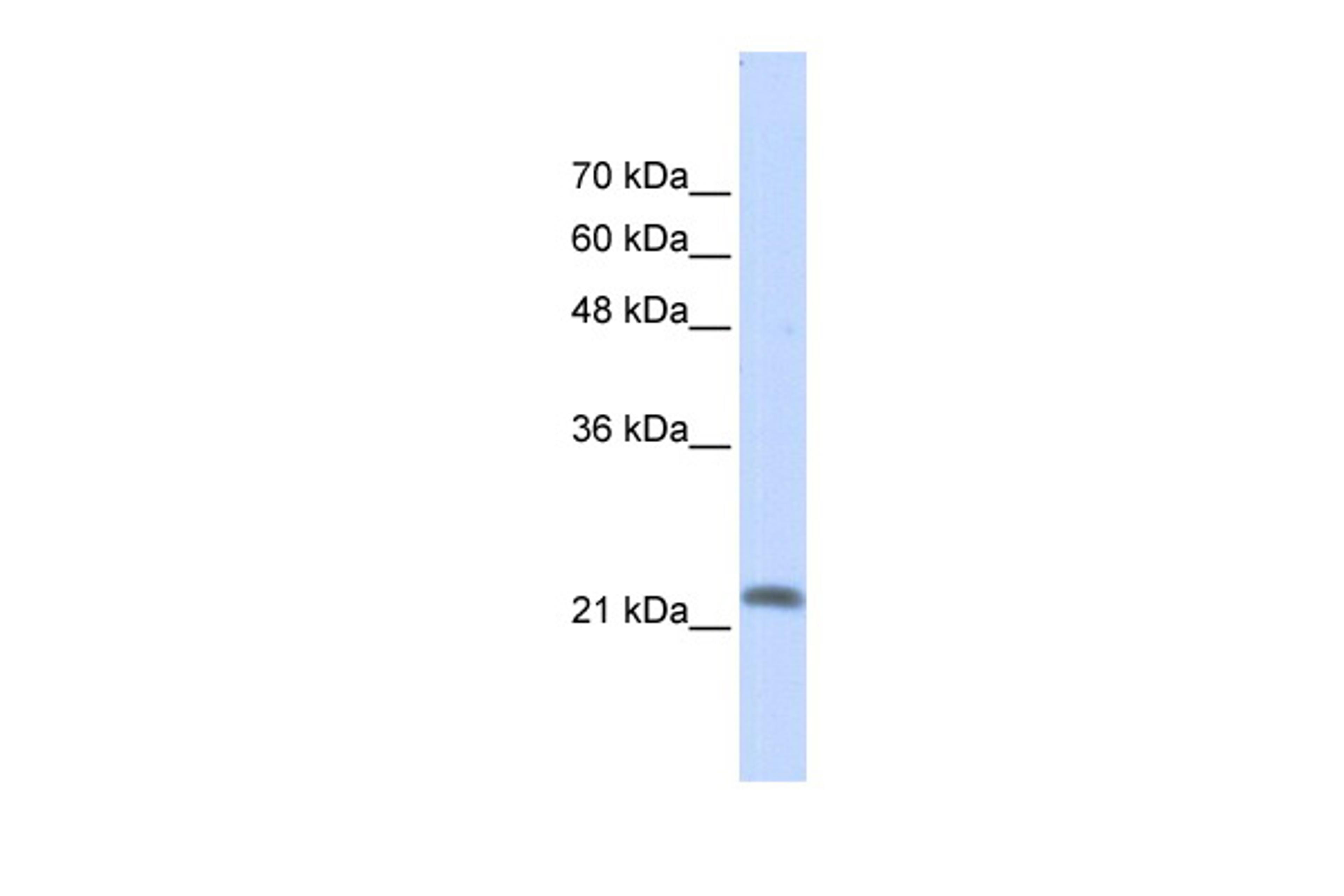 Antibody used in WB on Transfected 293T at 0.2-1 ug/ml.