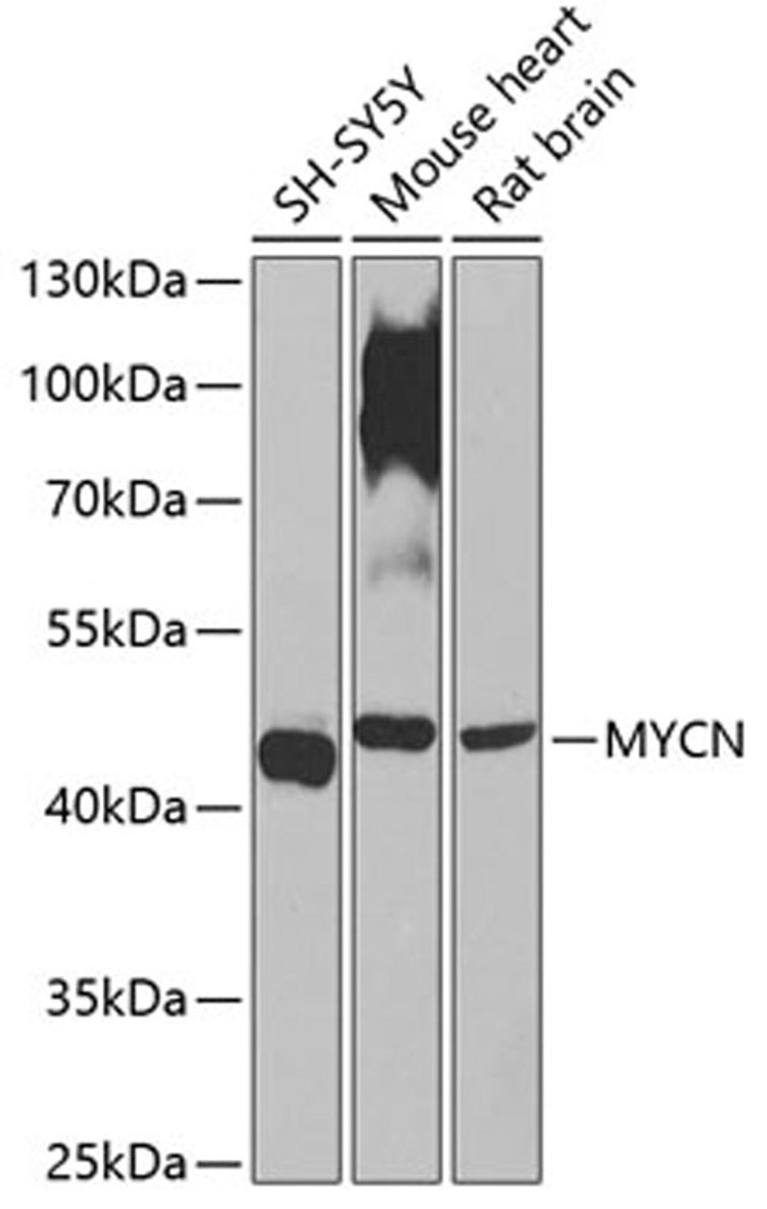 Western blot - MYCN antibody (A0499)