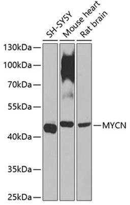 Western blot - MYCN antibody (A0499)