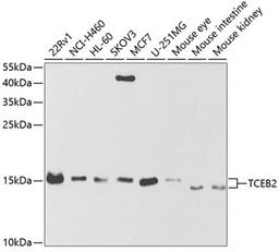 Western blot - TCEB2 antibody (A5362)