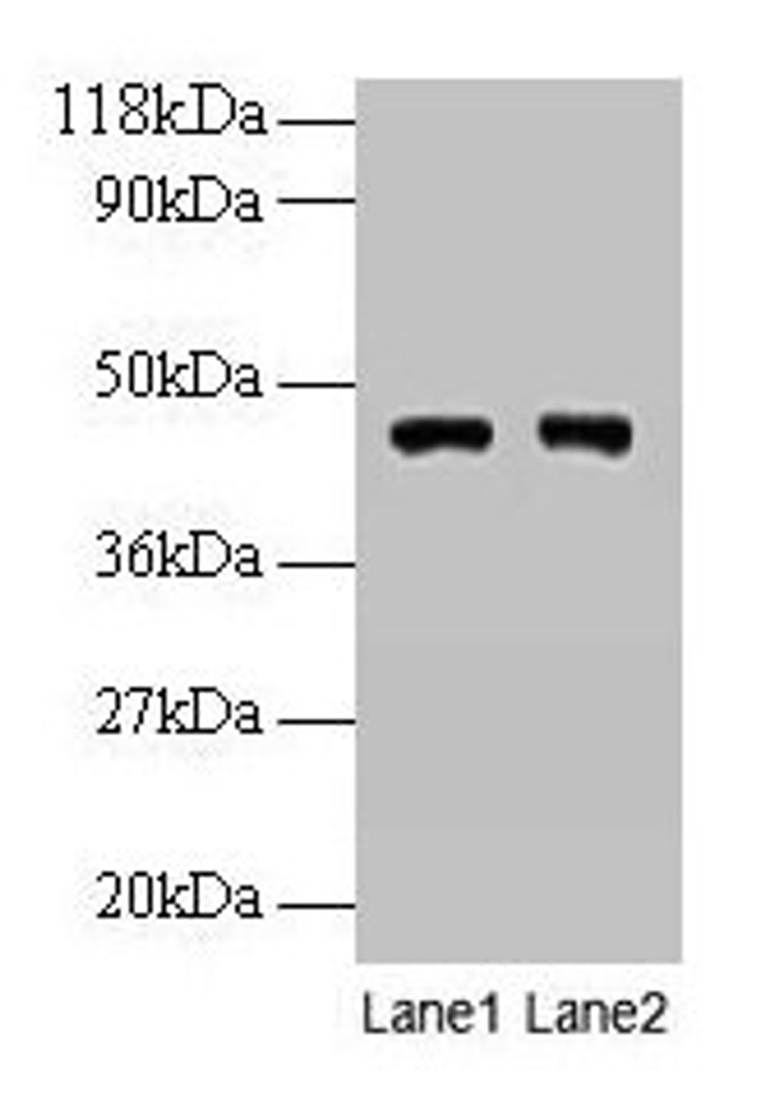 Western blot. All lanes: PGK1 antibody at 2µg/ml. Lane 1: EC109 whole cell lysate. Lane 2: 293T whole cell lysate. Secondary. Goat polyclonal to rabbit IgG at 1/15000 dilution. Predicted band size: 45, 42 kDa. Observed band size: 45 kDa