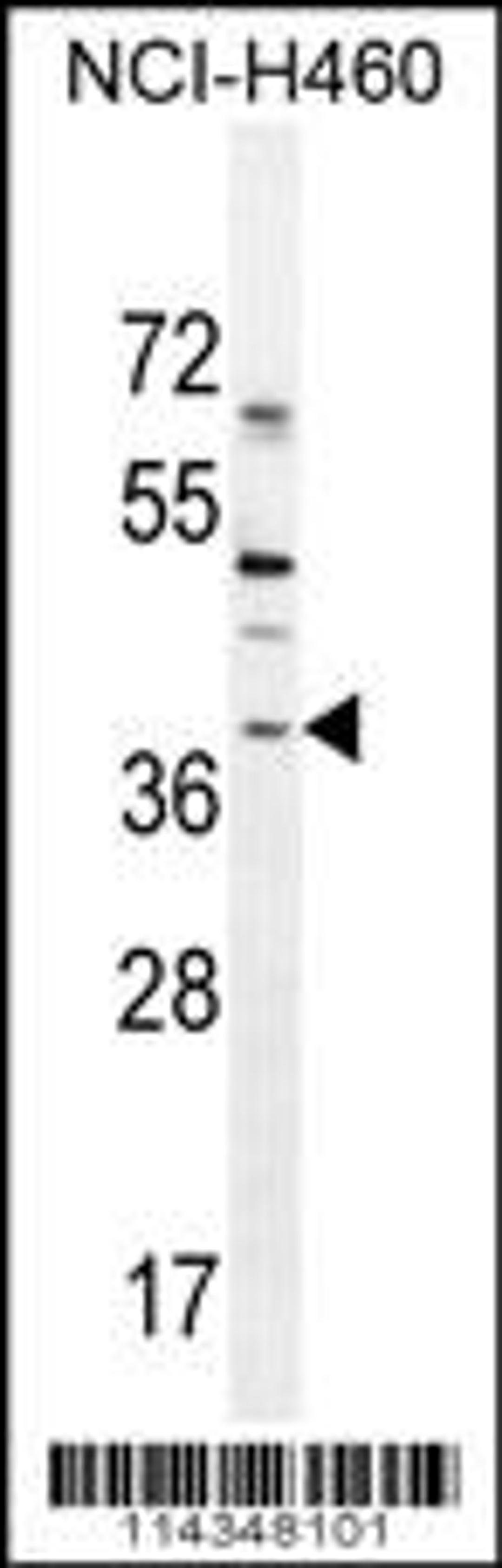 Western blot analysis in NCI-H460 cell line lysates (35ug/lane).