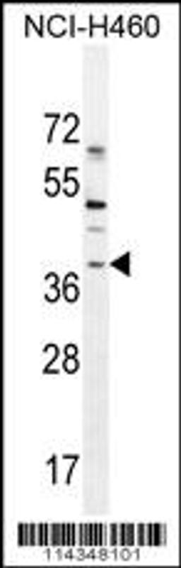 Western blot analysis in NCI-H460 cell line lysates (35ug/lane).