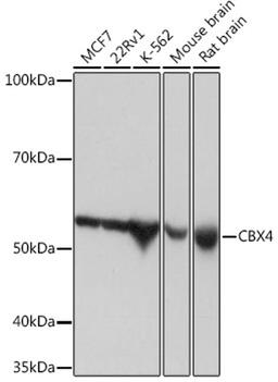 Western blot - CBX4 Rabbit mAb (A5109)