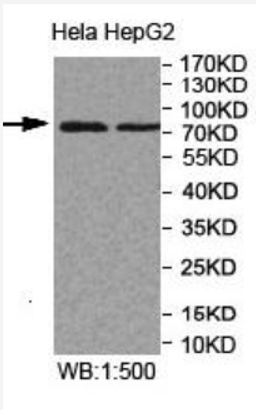 Western blot analysis of HeLa and HepG2 lysates using MPEG1 antibody